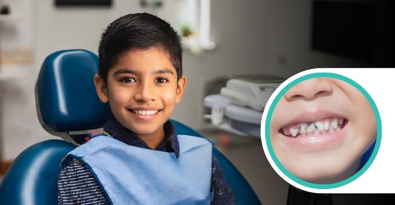 Kids Dental Care in Baramati