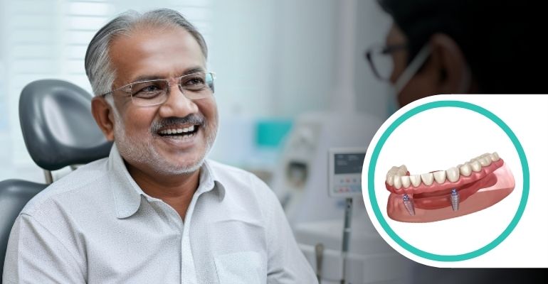 overdentures