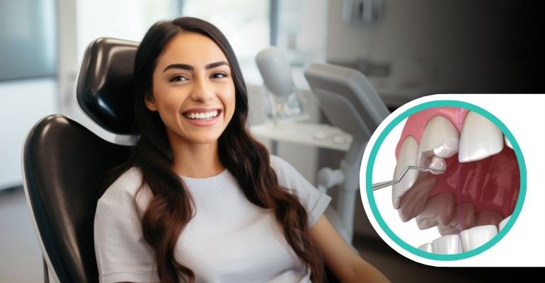 smile-makeover