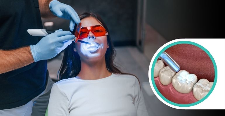tooth-colored-filling